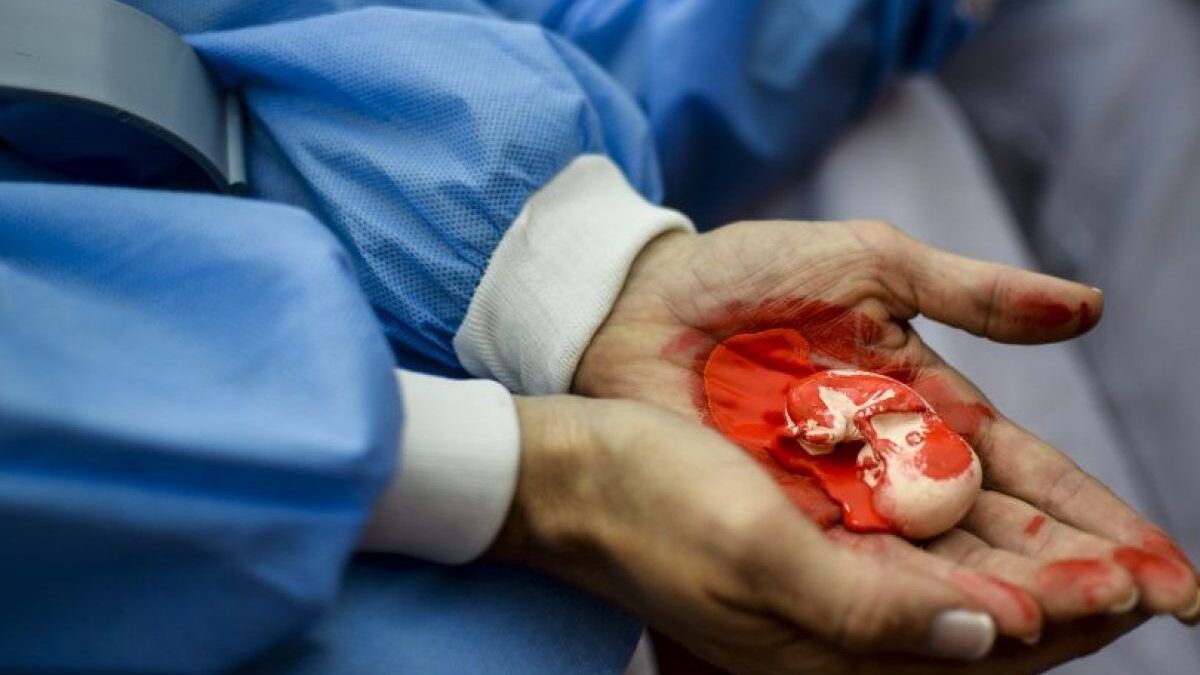 Imagen de un niño abortado
