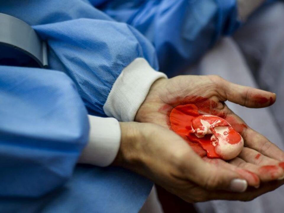 Imagen de un niño abortado