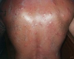 Inmensas nubes de mosquitos procedentes de Doñana invaden Sanlúcar y Matalascañas