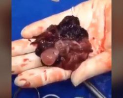 Muerte de un inocente. El vídeo de un aborto que se hace viral