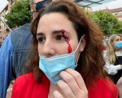 Proetarras y radicales vascos atentan contra un mitin de Vox hiriendo de una pedrada a su diputada en el Congreso Rocío de Meer