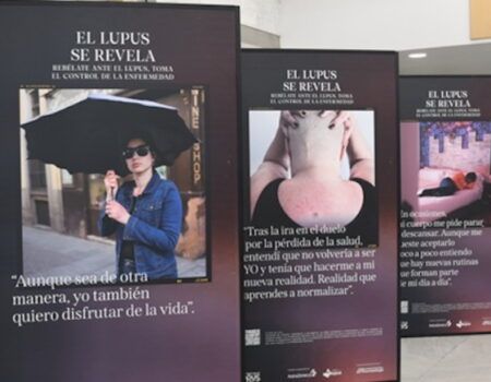 Exposición fotográfica «El Lupus se revela, rebélate ante el Lupus» en el Hospital Virgen Macarena de Sevilla