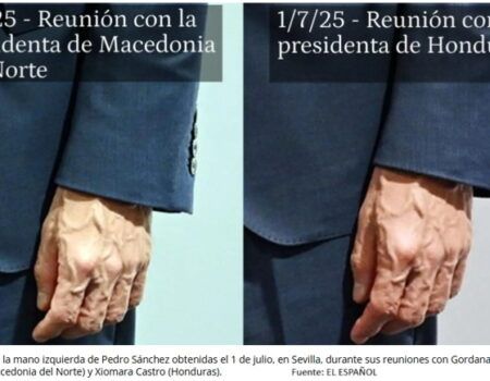La Moncloa y el equipo médico habitual